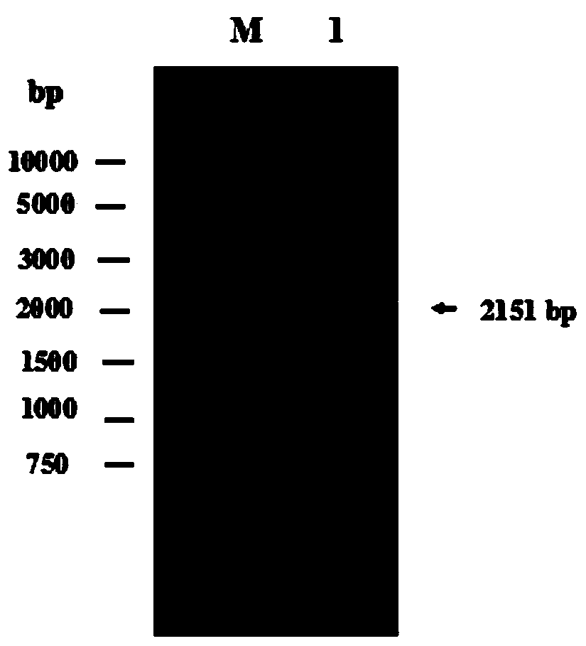 A kind of genetically engineered bacteria expressing microbial cholesterol esterase and its construction method