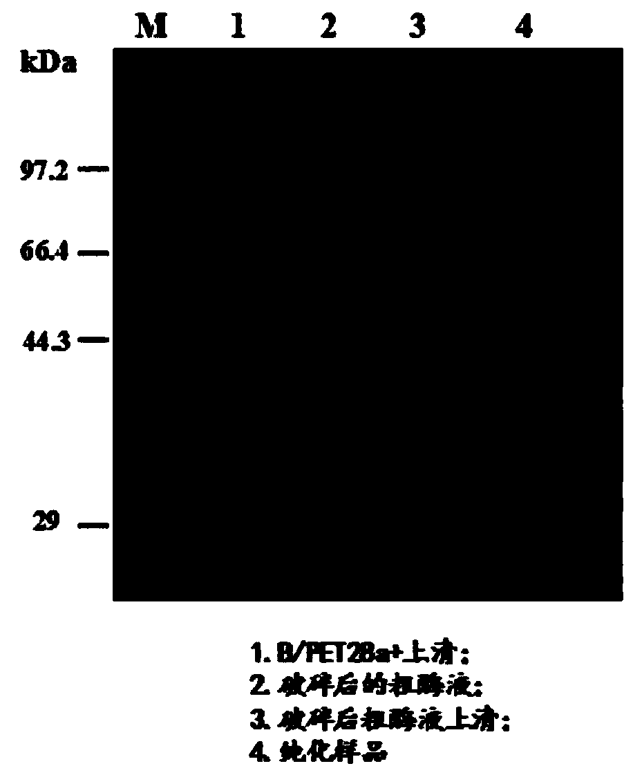 A kind of genetically engineered bacteria expressing microbial cholesterol esterase and its construction method