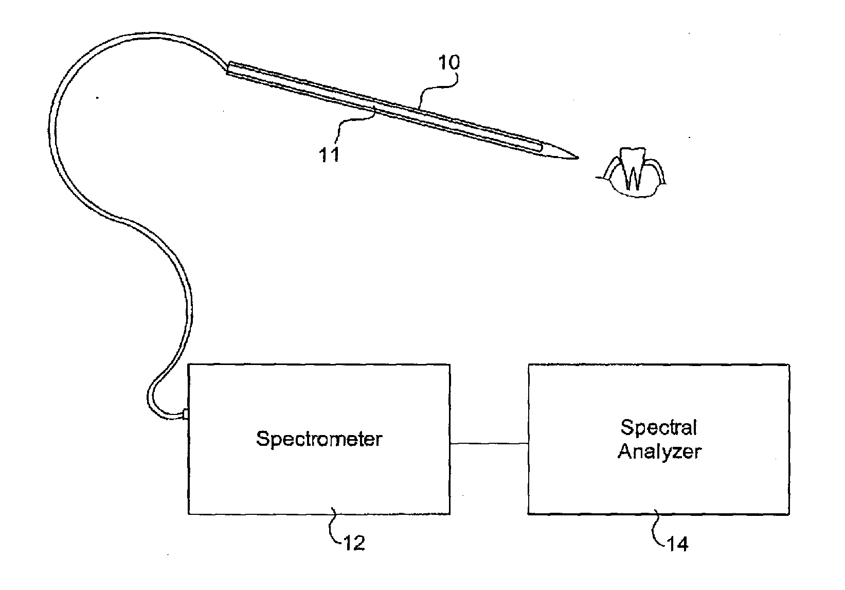 Method and apparatus for periodontal diagnosis