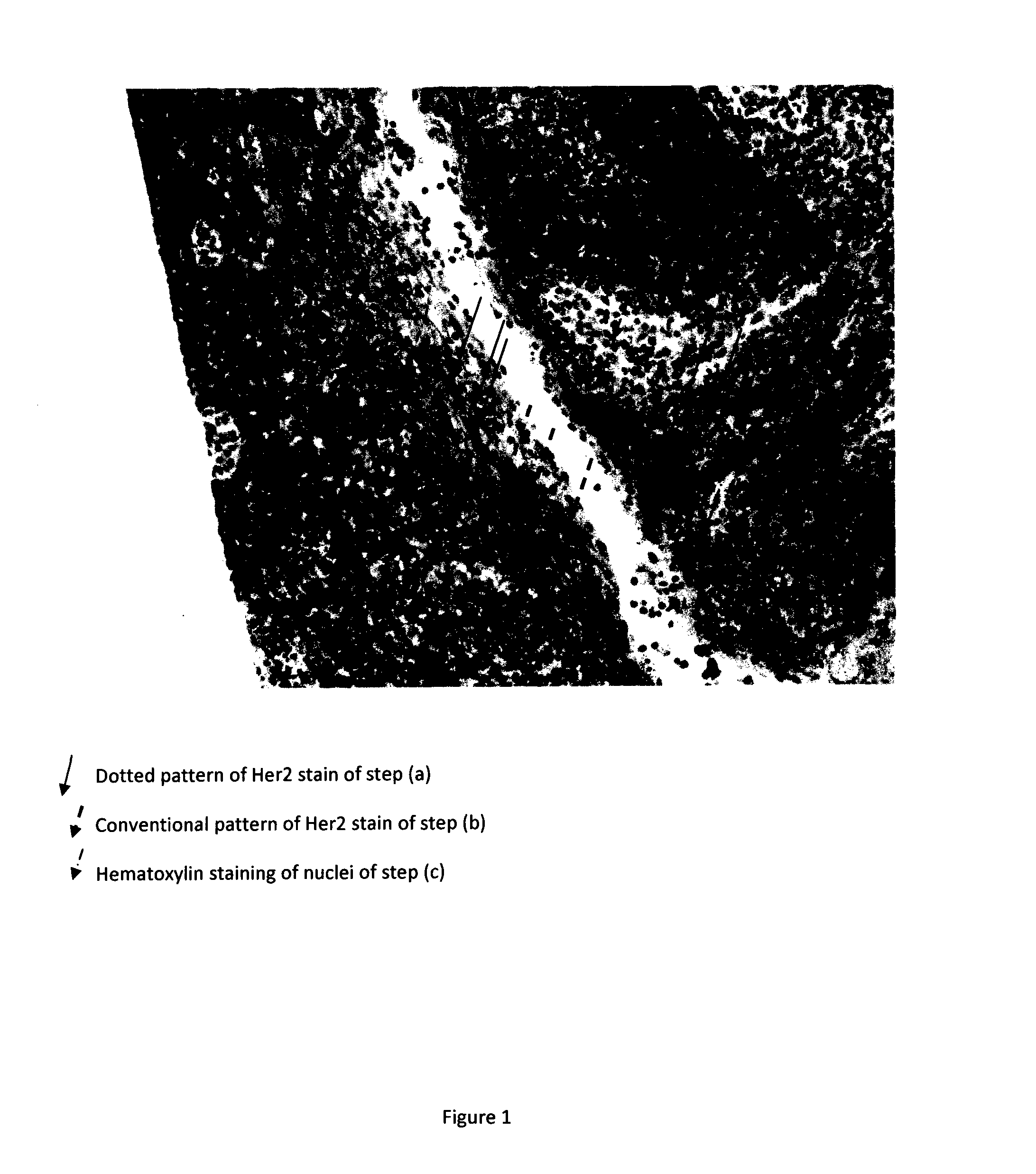 Combined histological stain