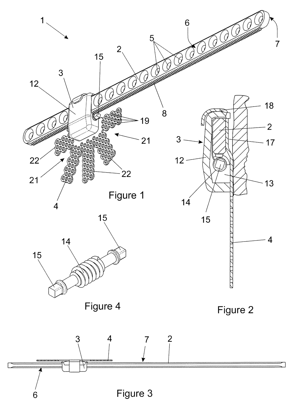 Transport distraction apparatus