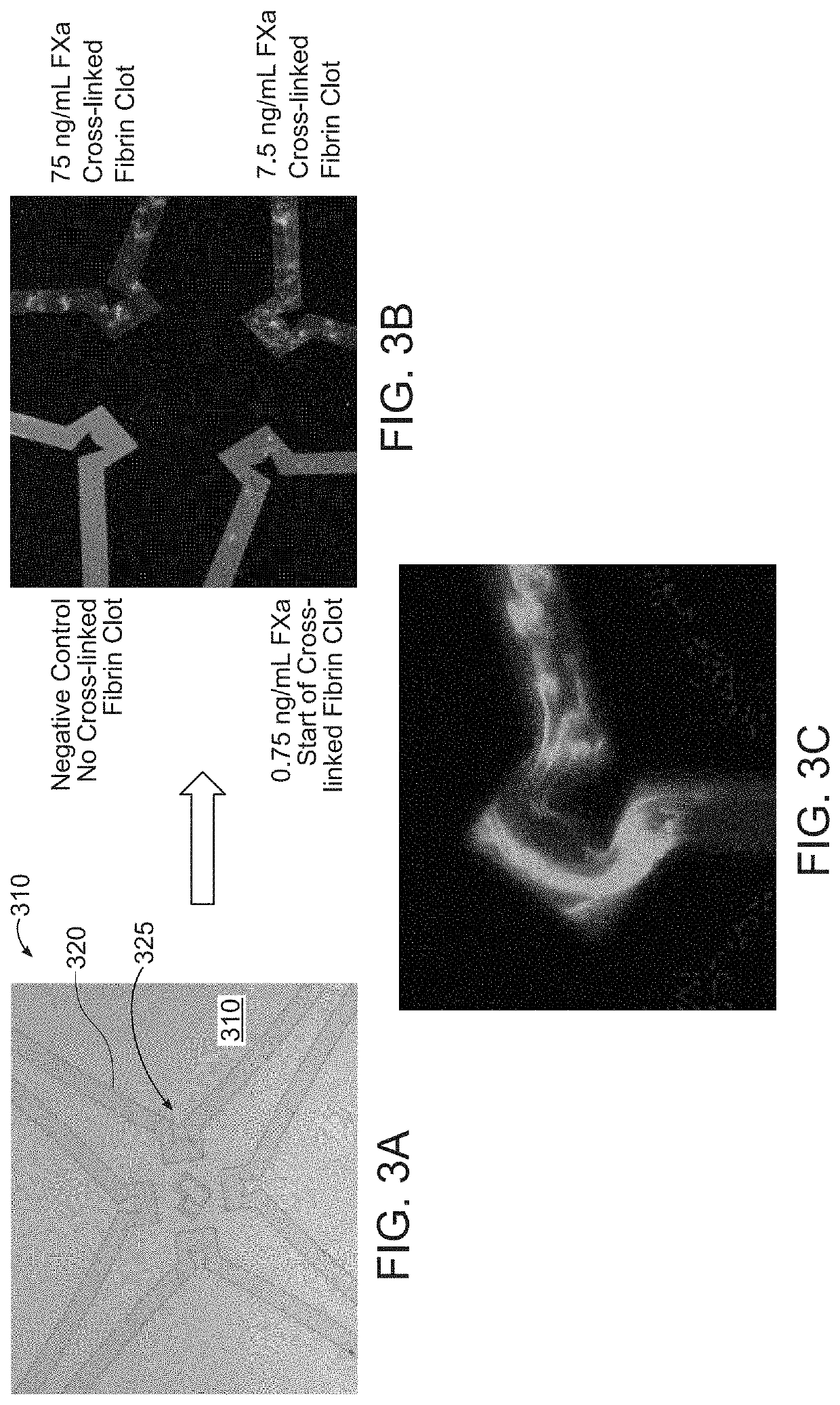 Methods and devices for detection of coagulation impairment