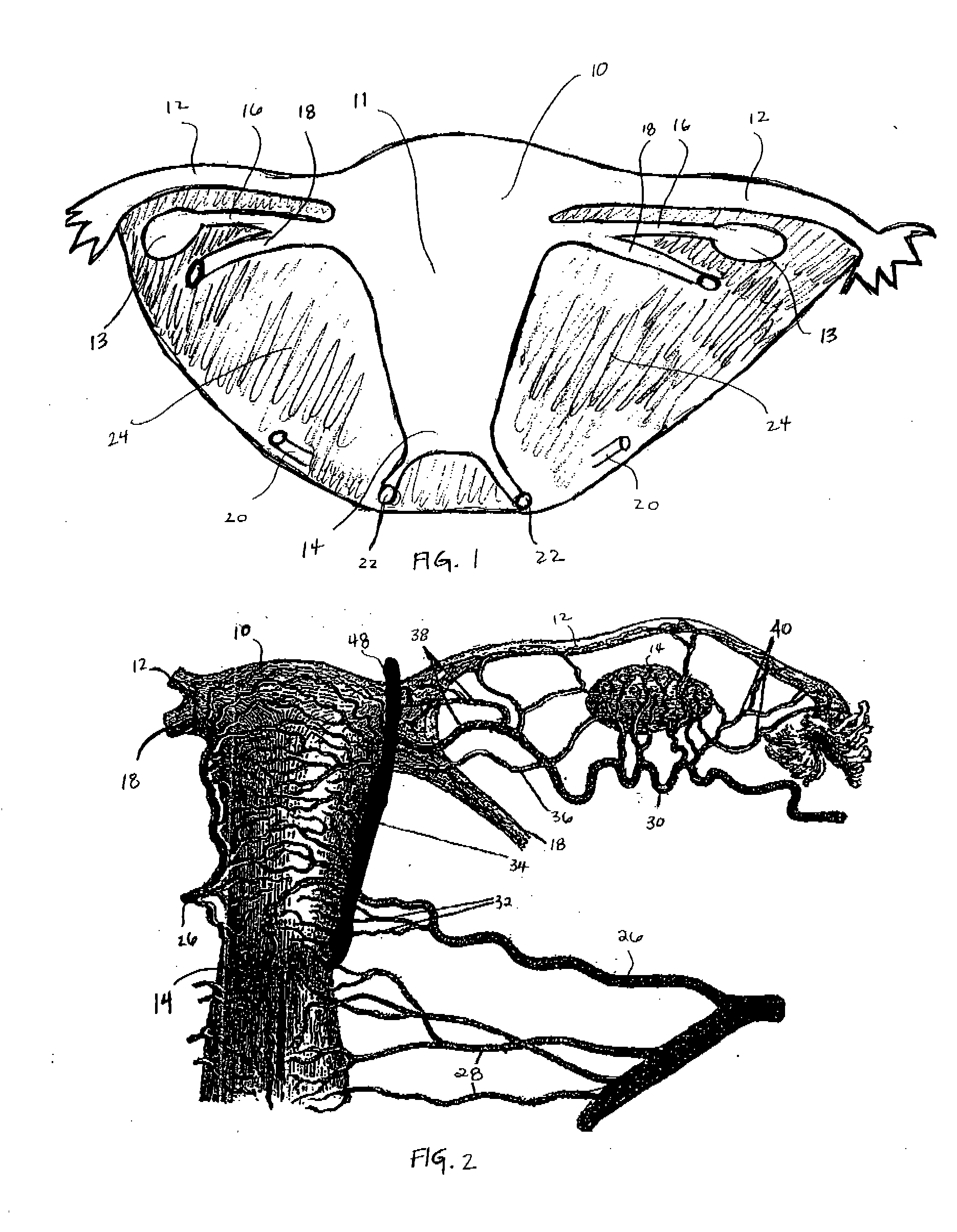 Method and Apparatus for Performing a Surgical Procedure