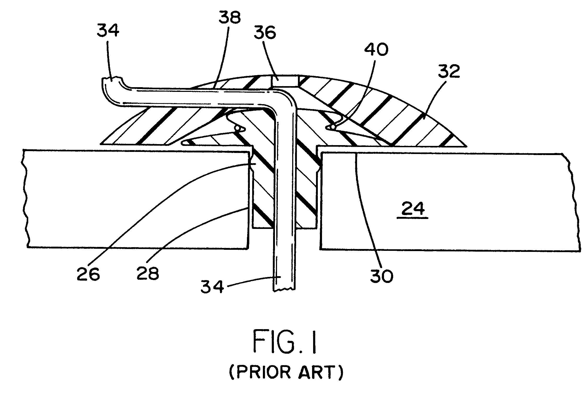 Electrode-lead coupling skull mounted port assembly