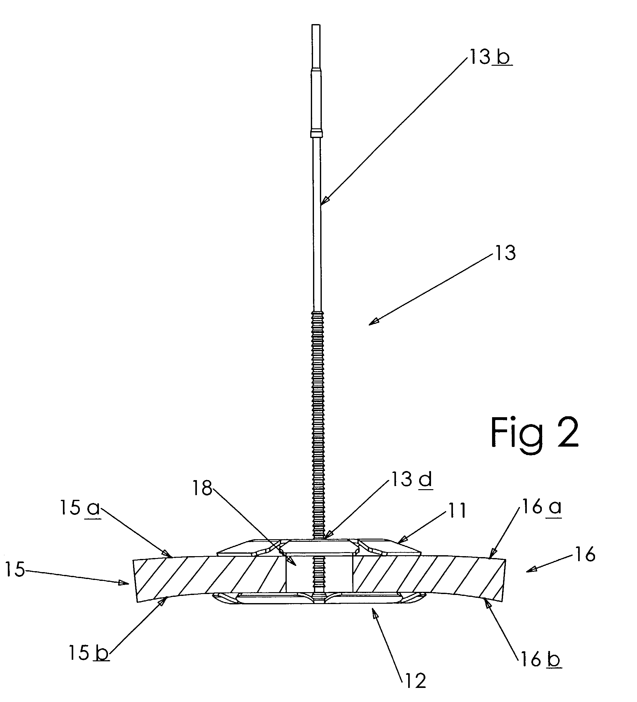 Cranial bone flap fixation system and method