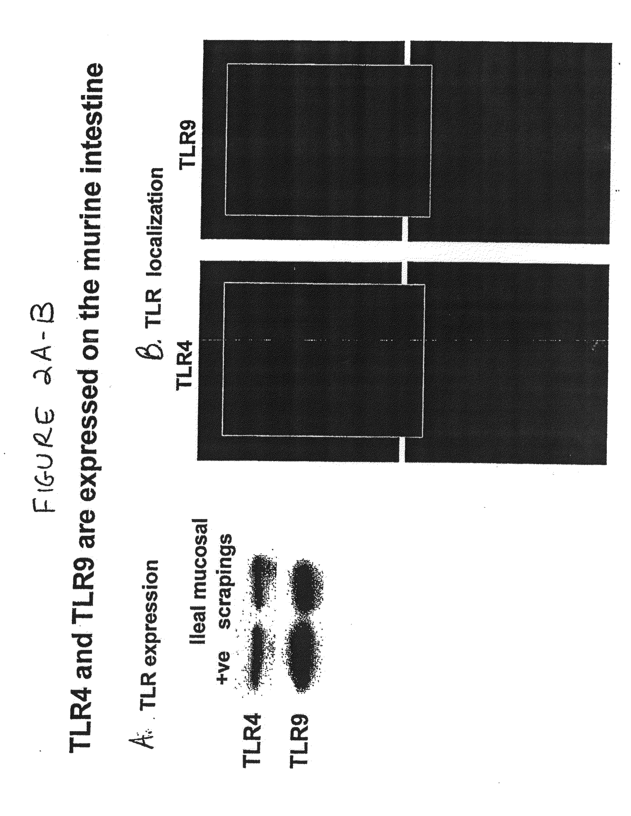 Use of Toll-like receptor-9 agonists, Toll-like receptor-4 antagonists, and/or nuclear oligomerization domain-2 agonists for the treatment or prevention of Toll-like receptor-4-associated disorders