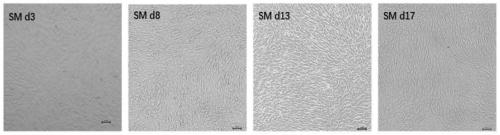 Method for inducing differentiation of human adipose derived stromal cells into liver cells through micromolecules