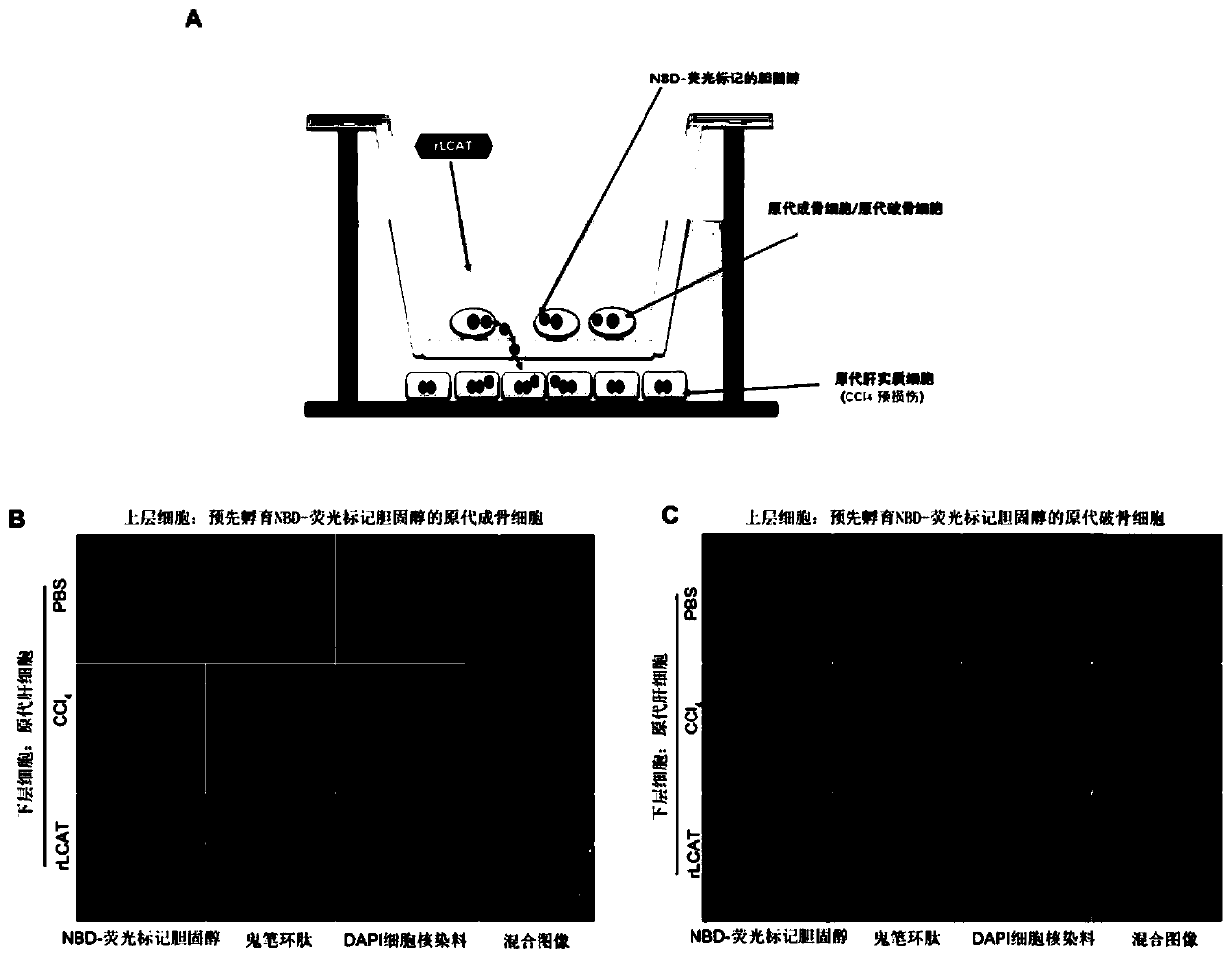 Use of lcat in the preparation of medicines for treating and/or preventing hepatic bone disease