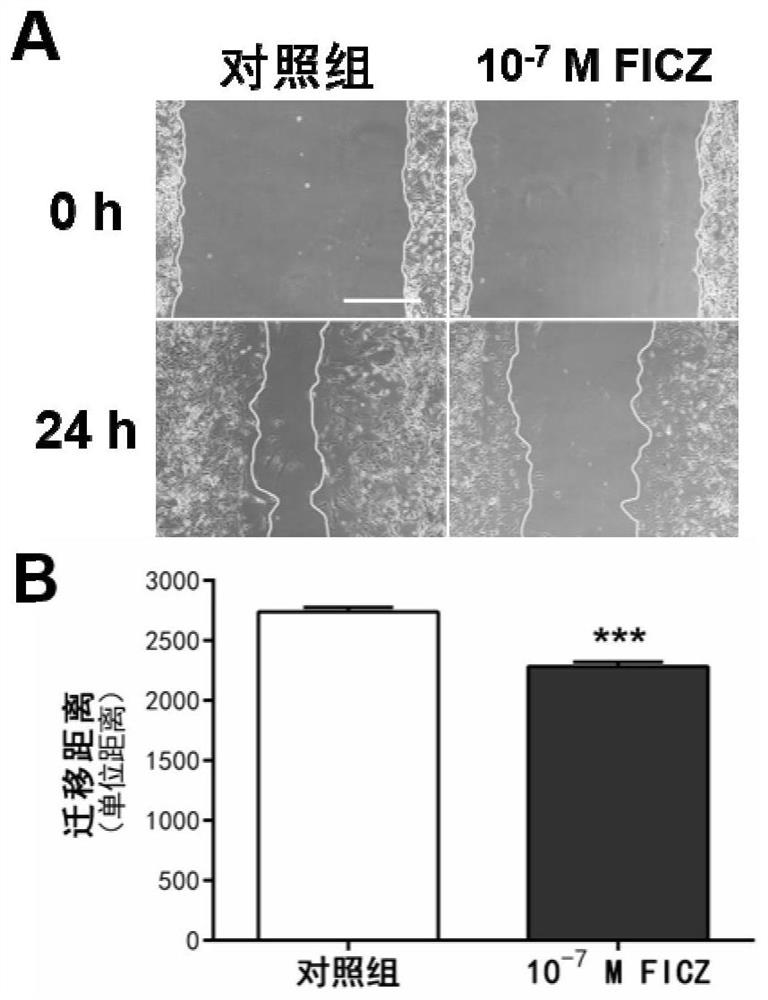 Application of FICZ in inhibition of tumor cell migration