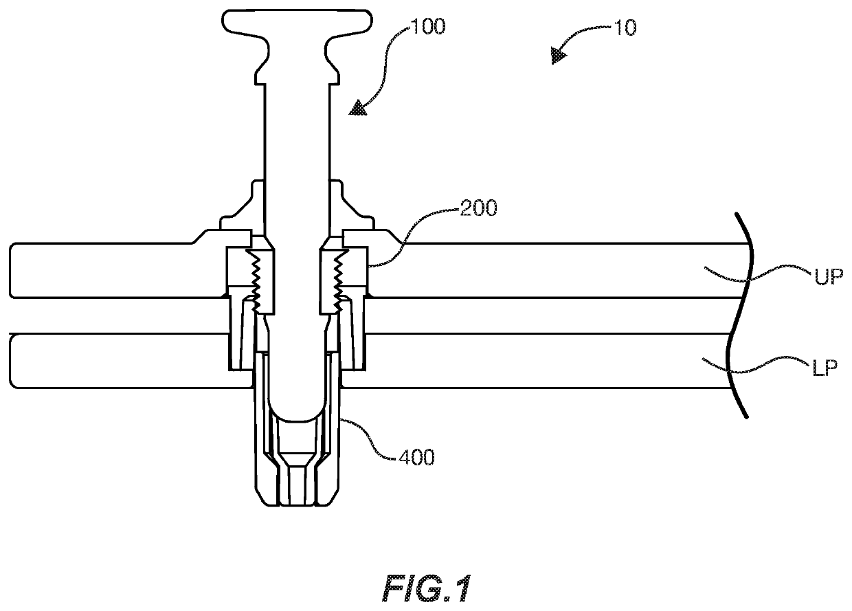 Pin Closure System