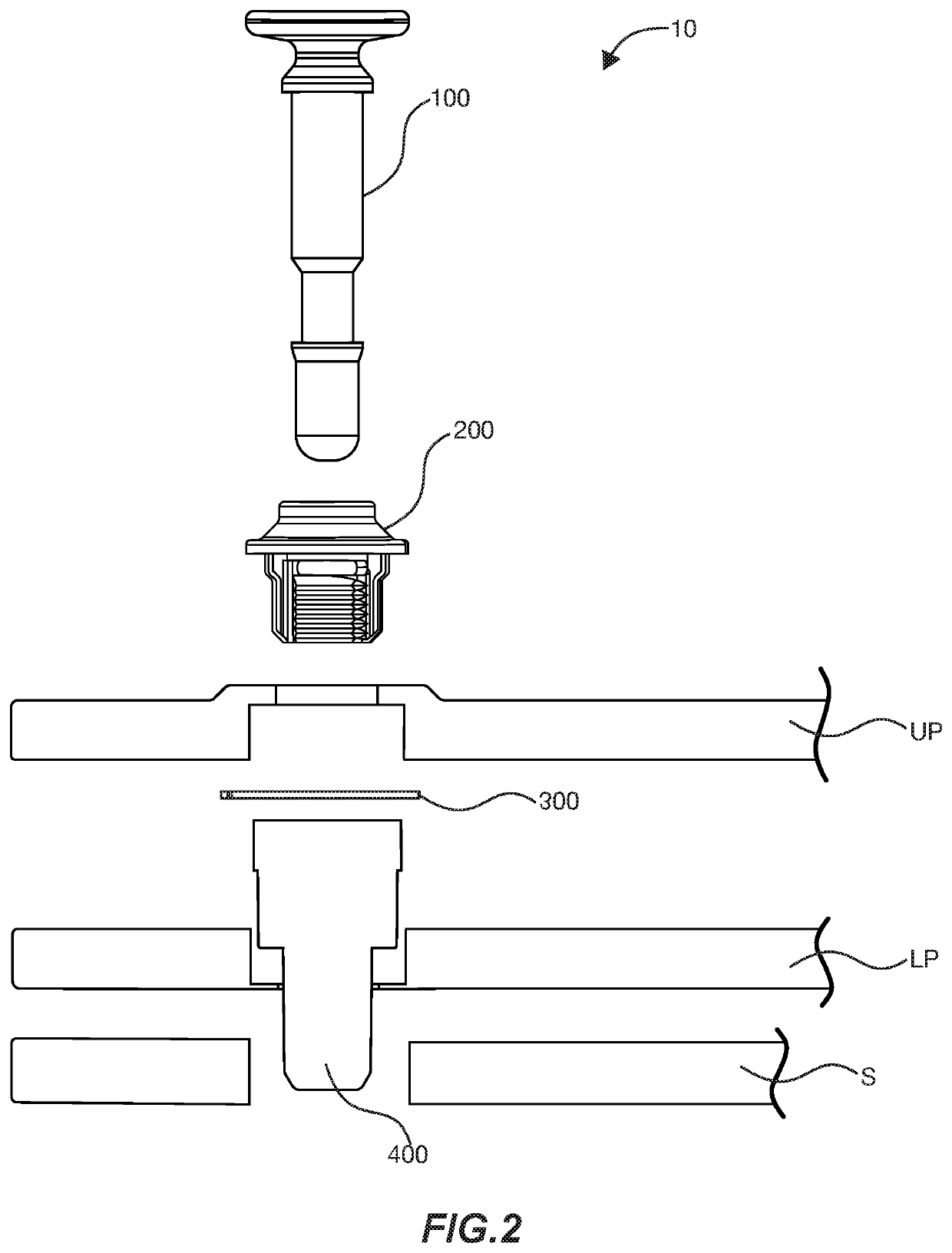 Pin Closure System