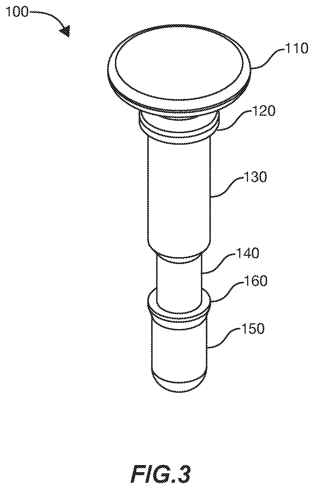 Pin Closure System