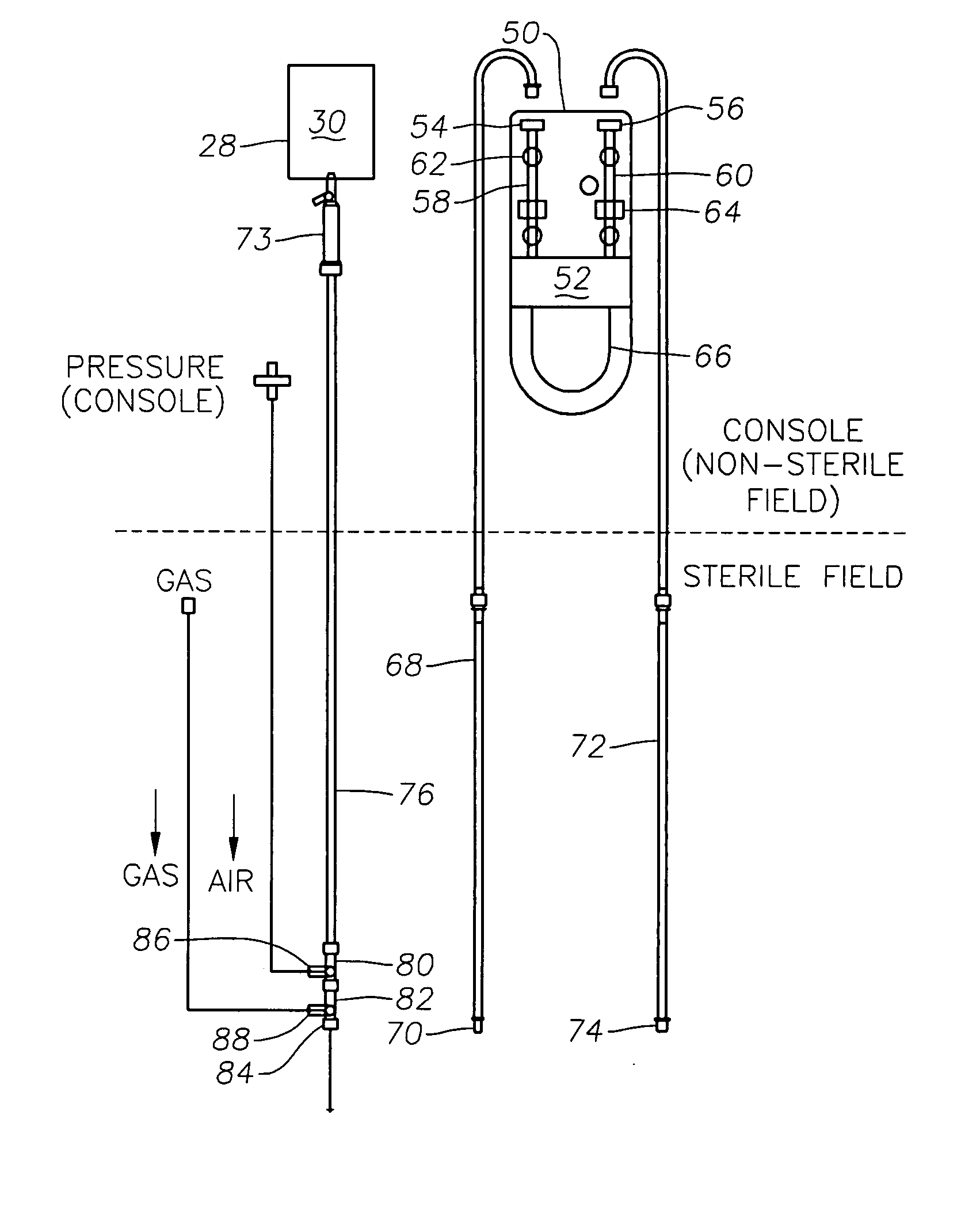 Surgical cassette and consumables for combined ophthalmic surgical procedure