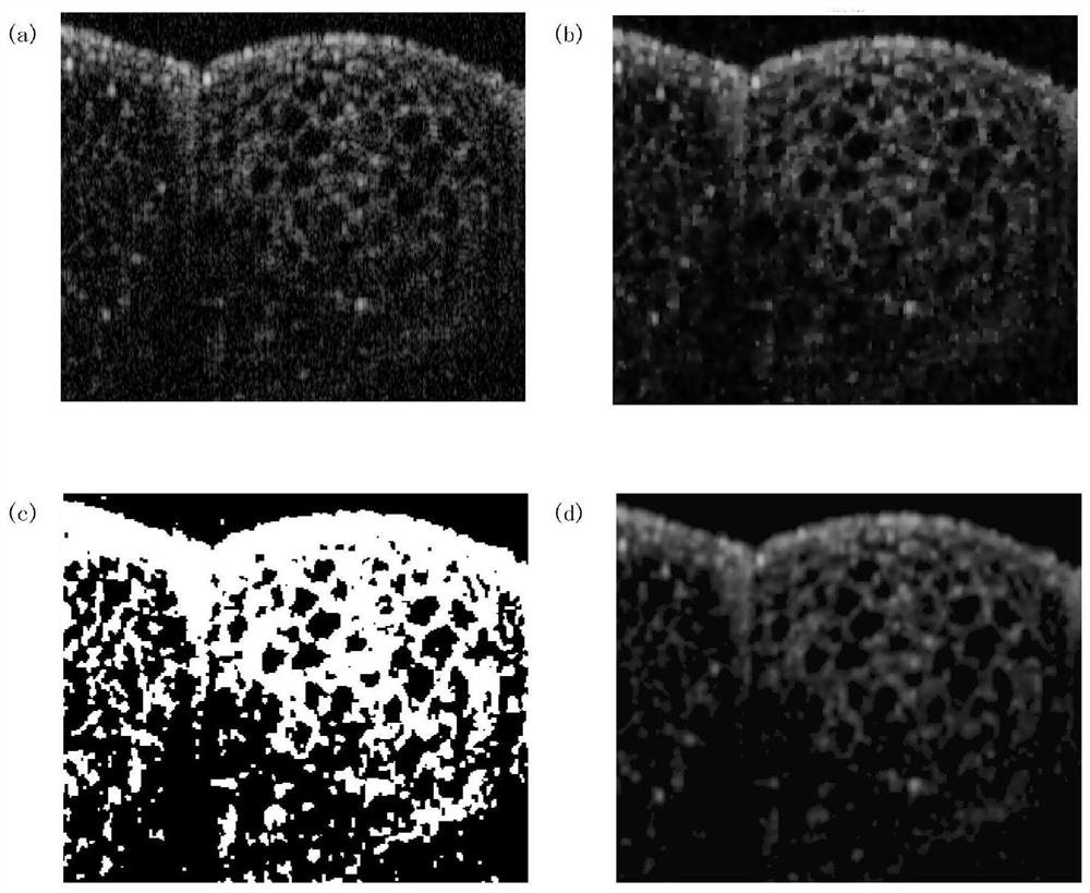 An improved nas-rif method for blind restoration of oct images