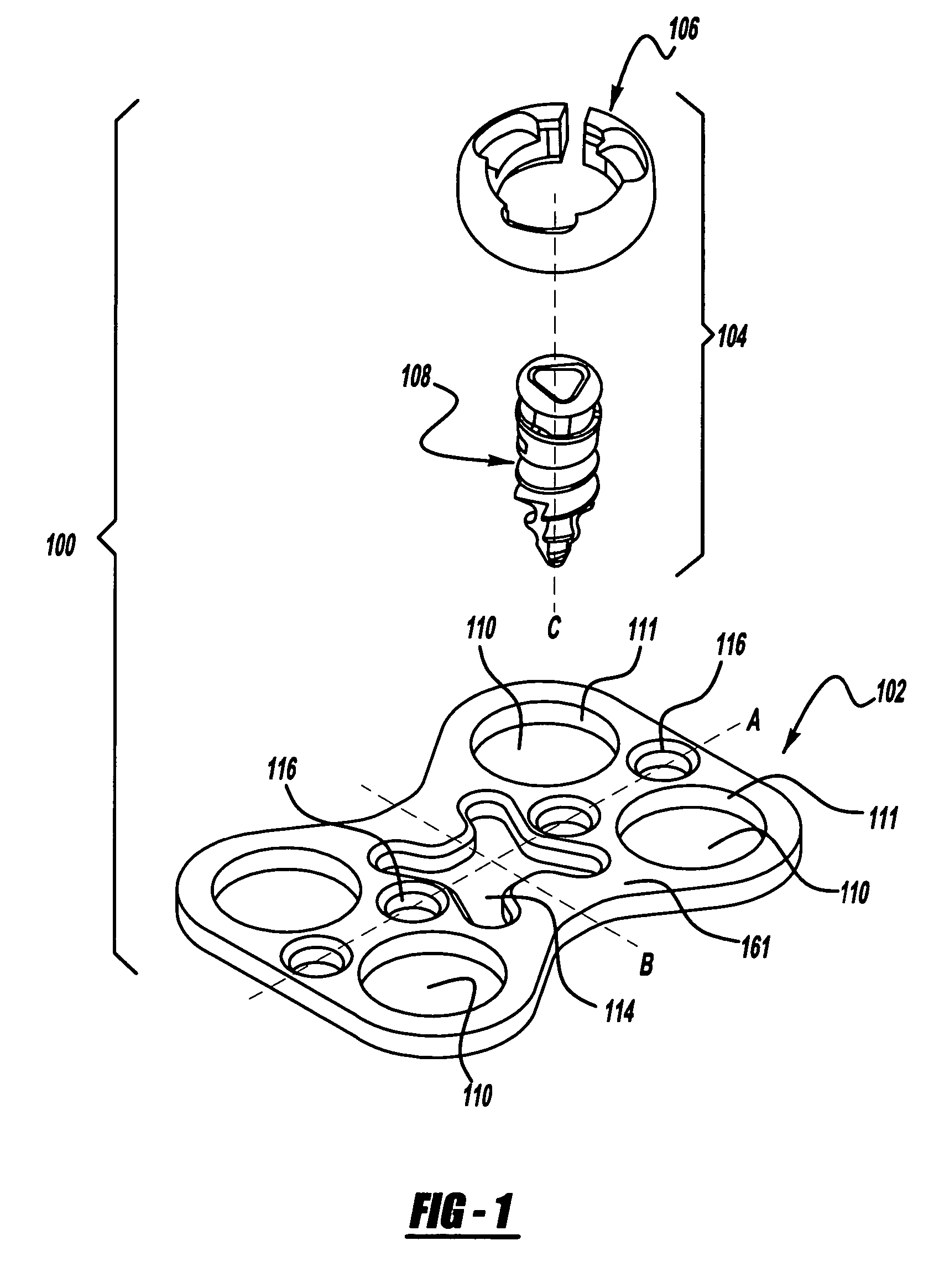 Bone fixation device