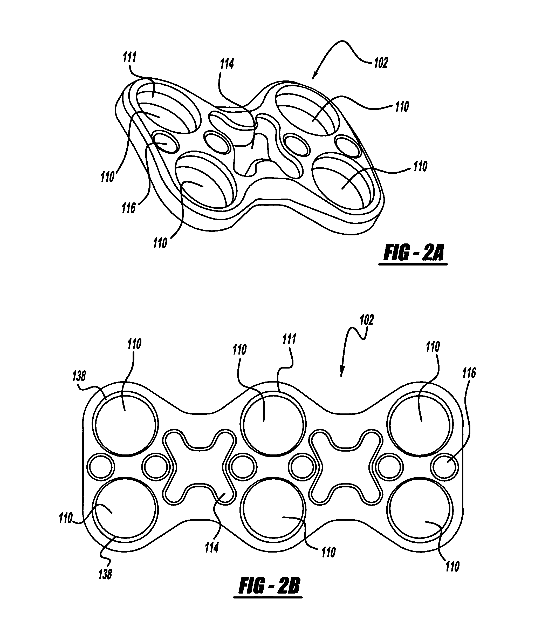 Bone fixation device