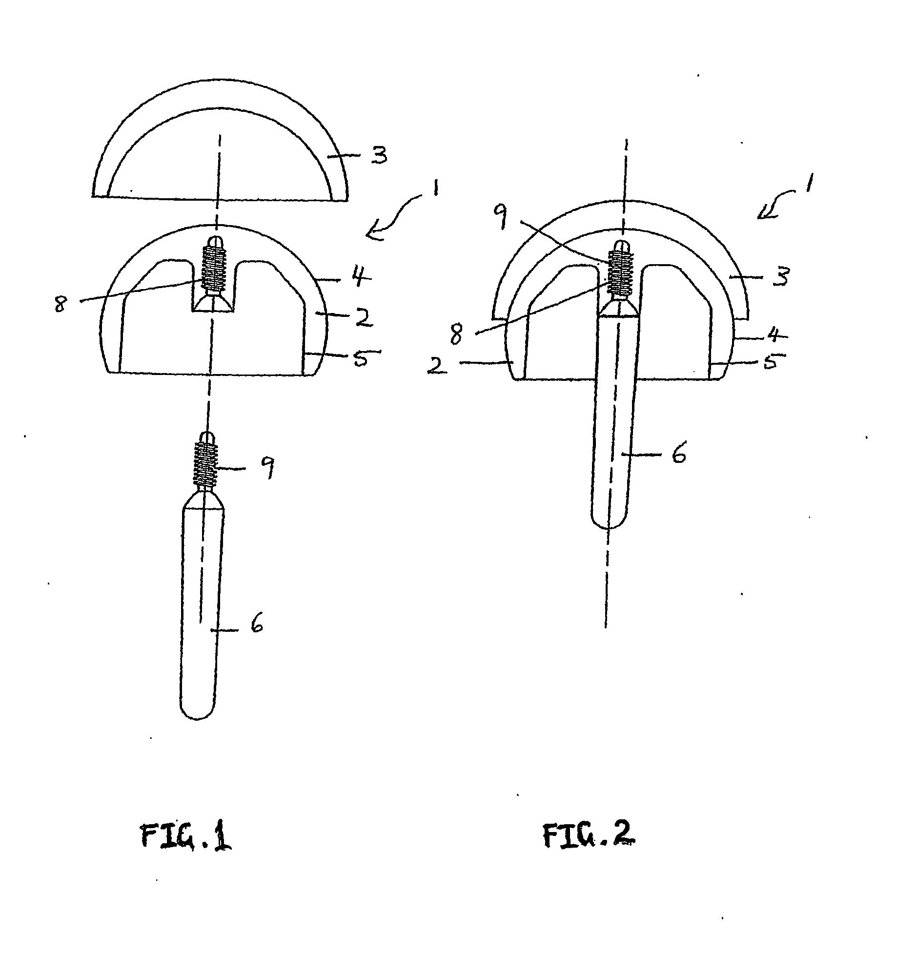 Hip Resurfacing Component