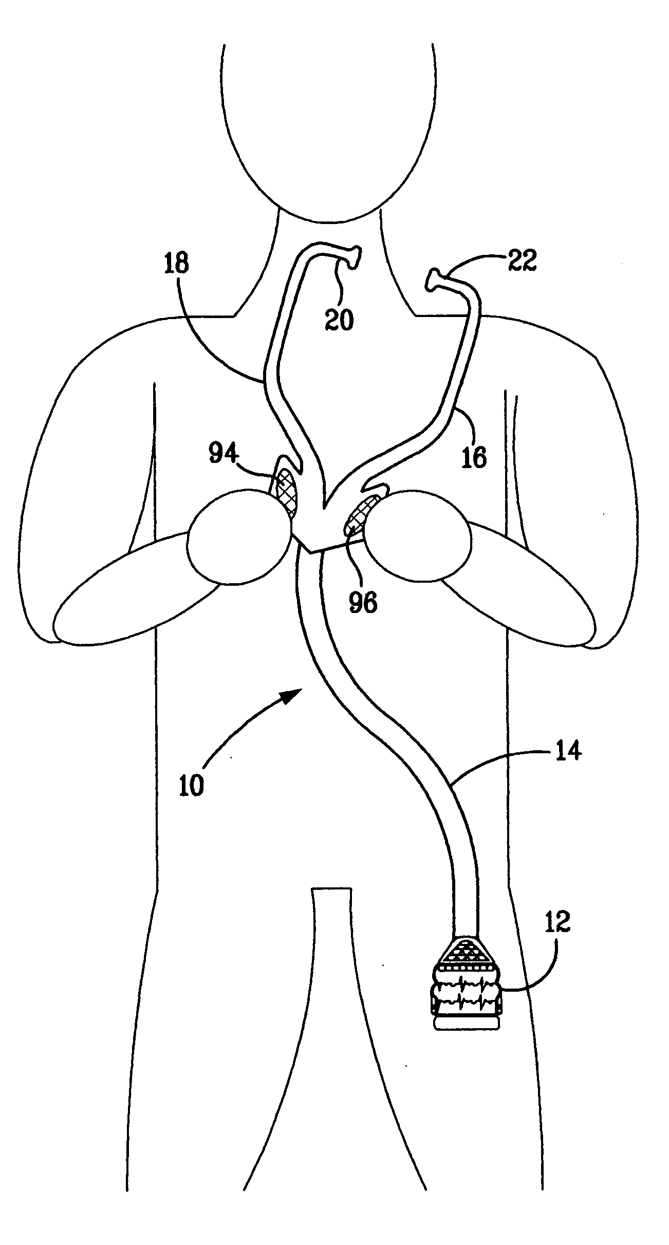 Medical examination apparatus