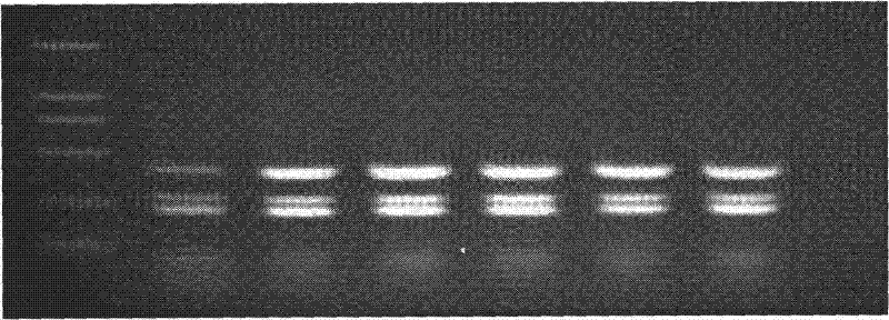 Multi-suspension chip for detecting Cryptosporidium and Giardia lamblia and preparation thereof