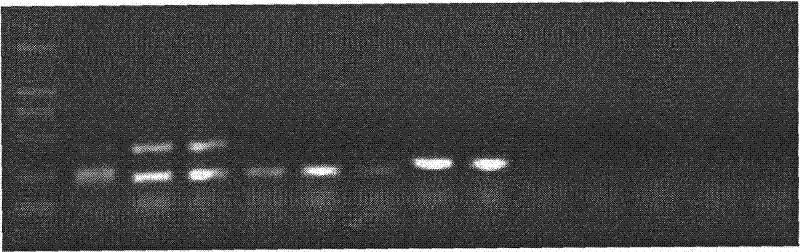 Multi-suspension chip for detecting Cryptosporidium and Giardia lamblia and preparation thereof