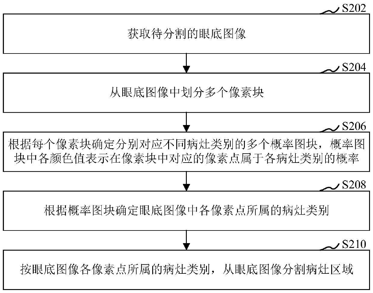 Fundus image segmentation method, device, storage medium and computer equipment