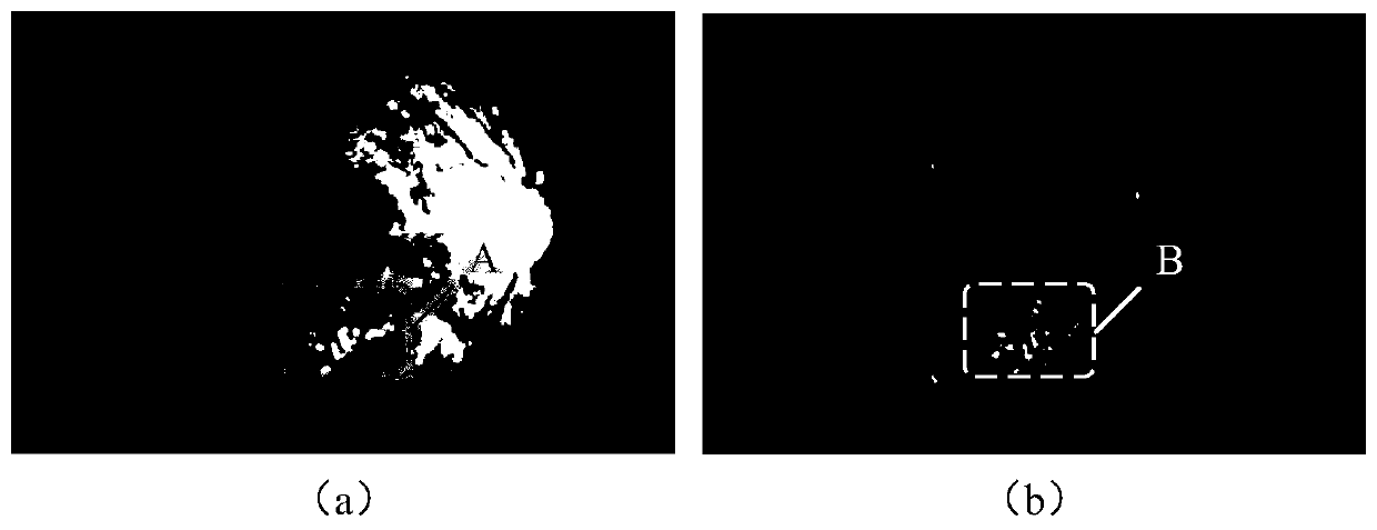 Fundus image segmentation method, device, storage medium and computer equipment