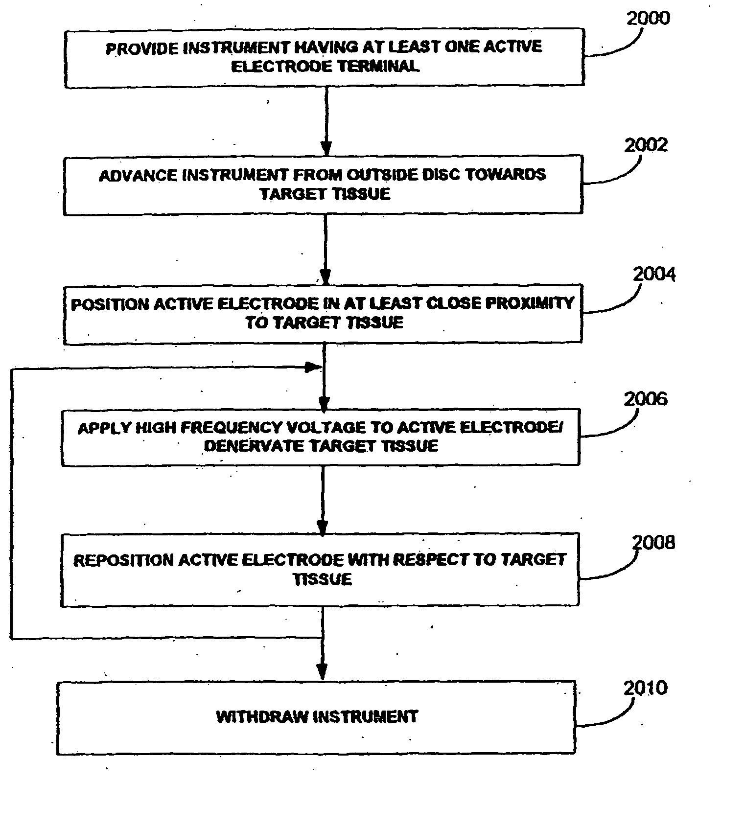 Methods and apparatus for treating back pain