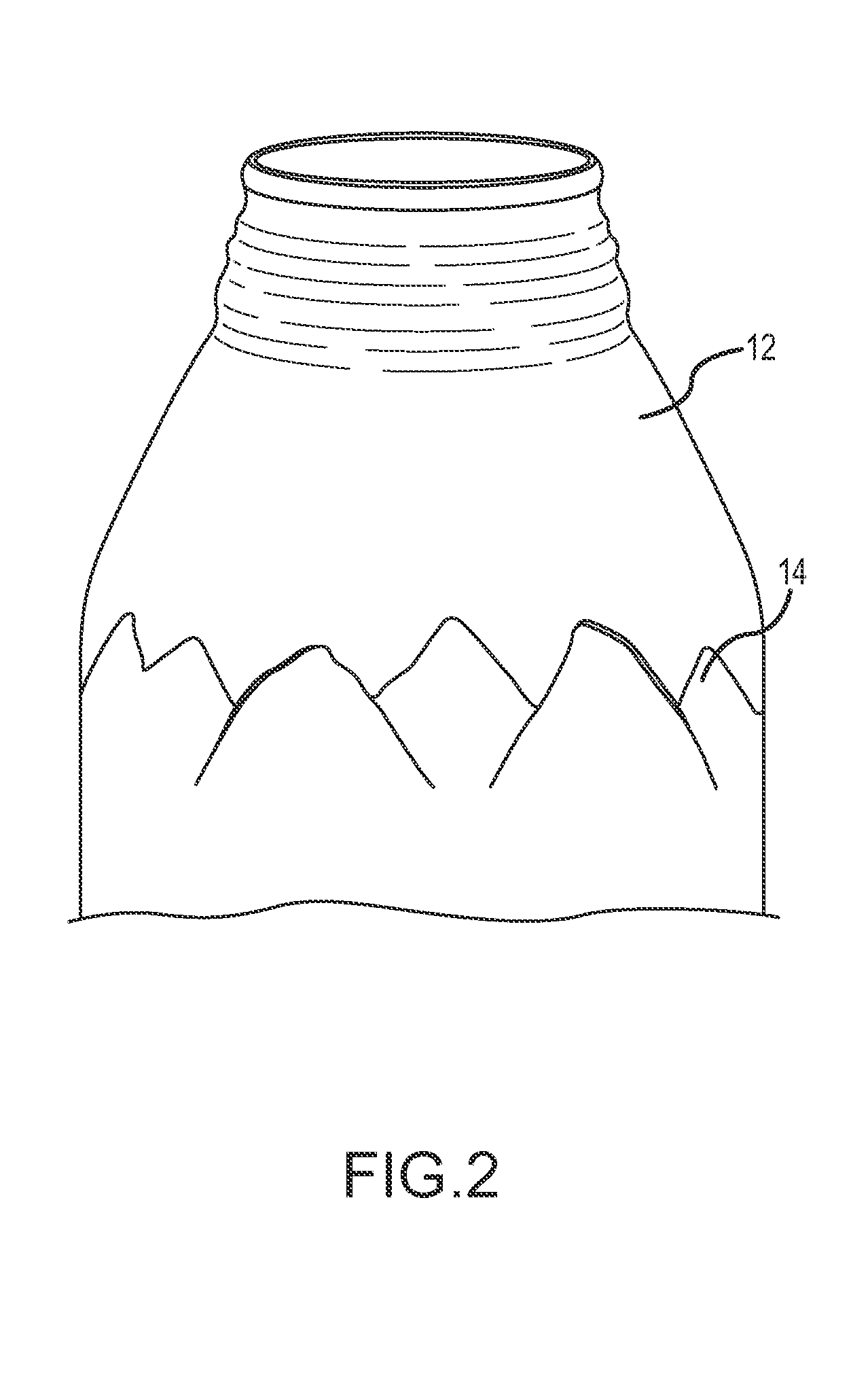 System for compression relief shaping