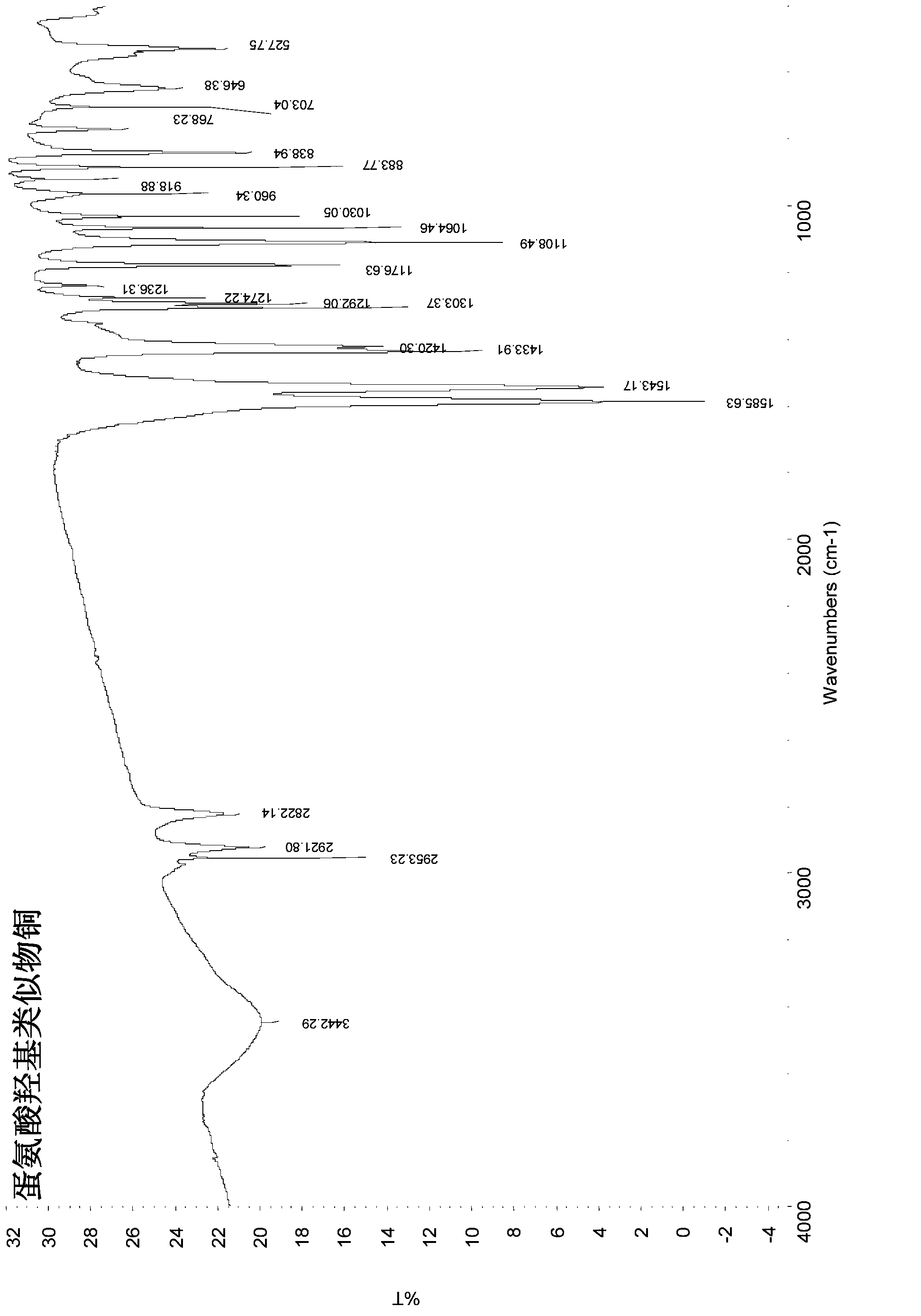 Preparation method of microelement methionine hydroxy analogue chelate additive