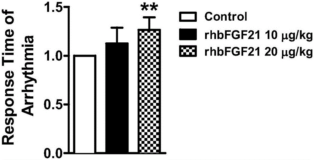 Application of recombination human fibroblast growth factor-21 in preparation of medicament for preventing and treating ischemic arrhythmia