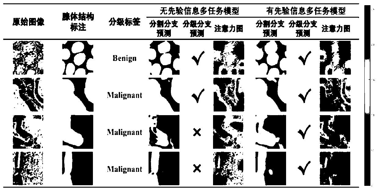 Adenocarcinoma pathological image analysis method based on priori perception and multi-task learning