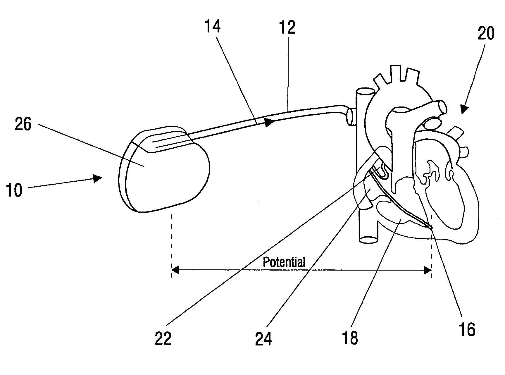 Electrotherapy device