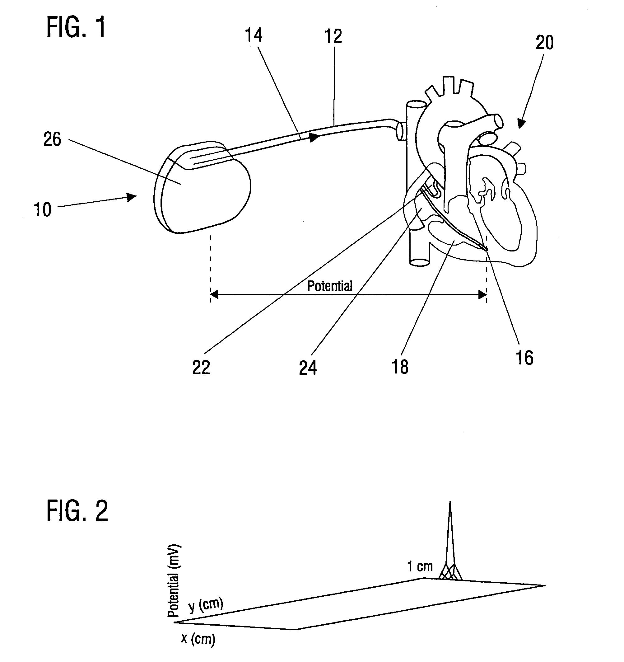 Electrotherapy device