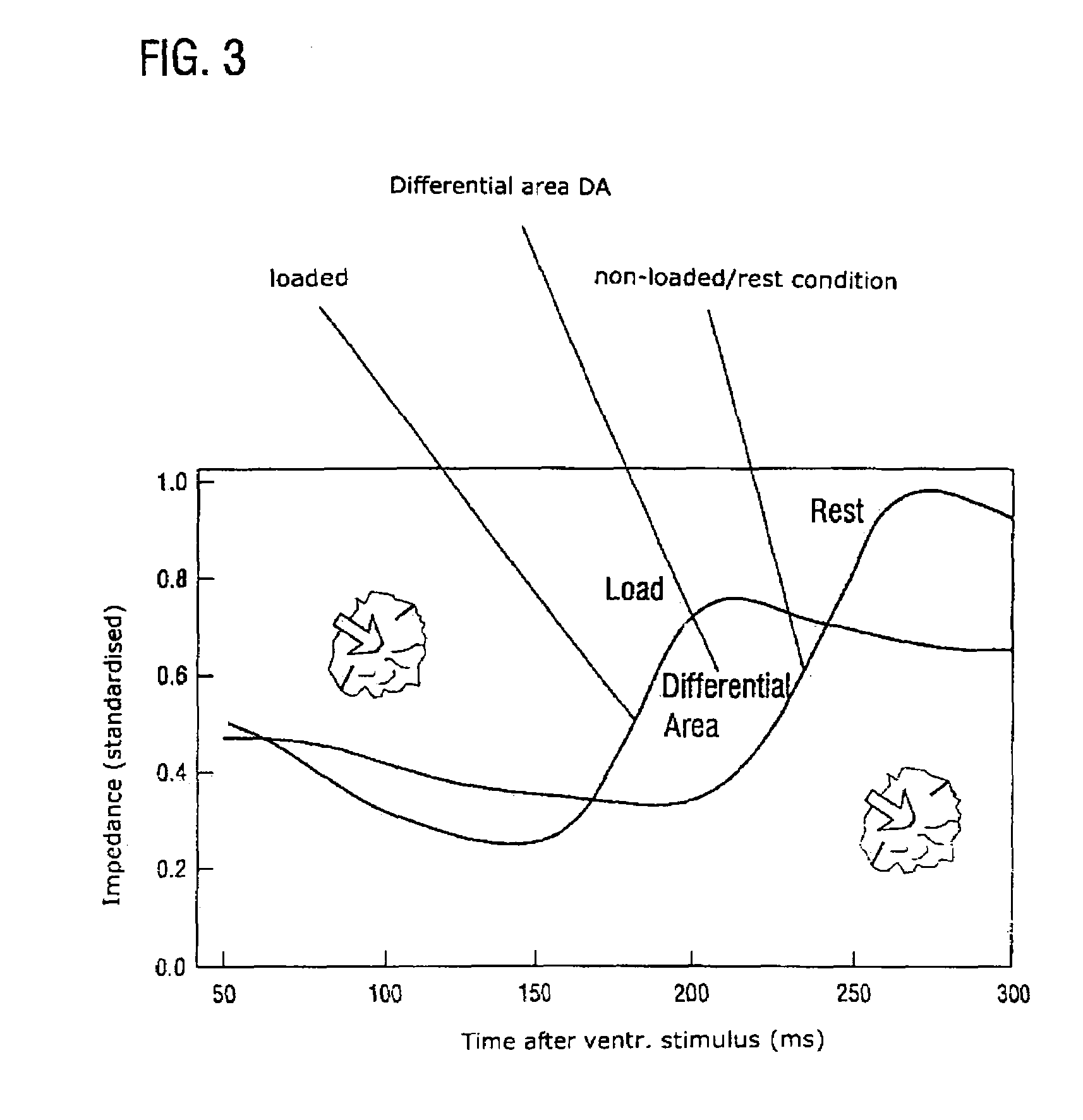 Electrotherapy device