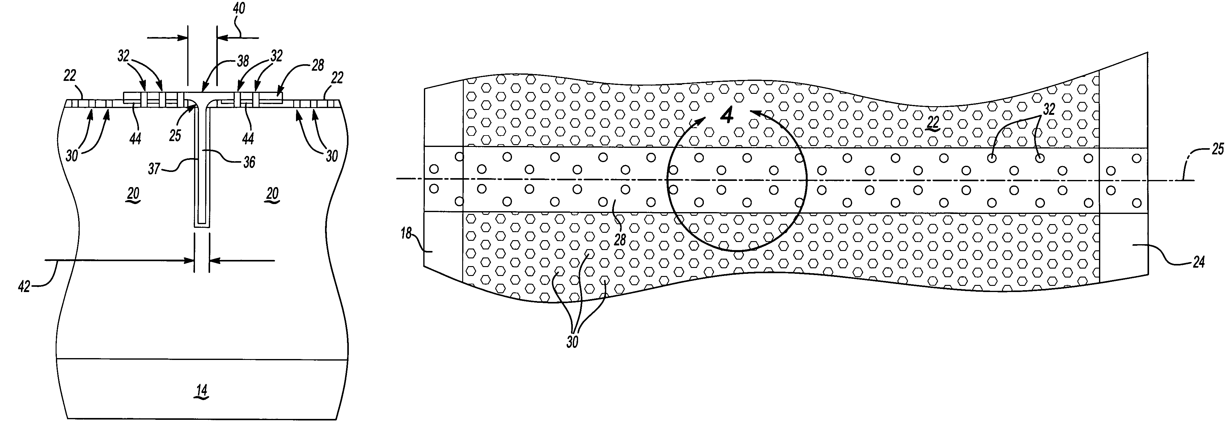 Acoustic mechanical retainer