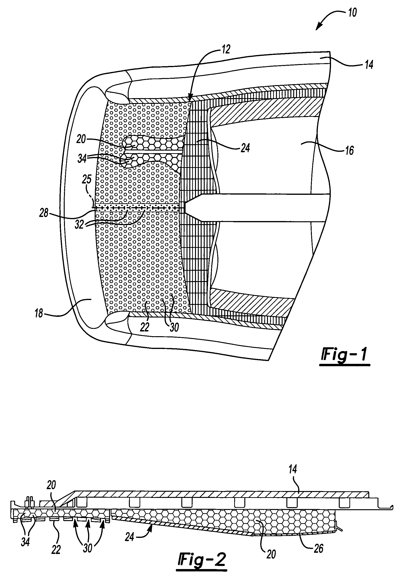 Acoustic mechanical retainer