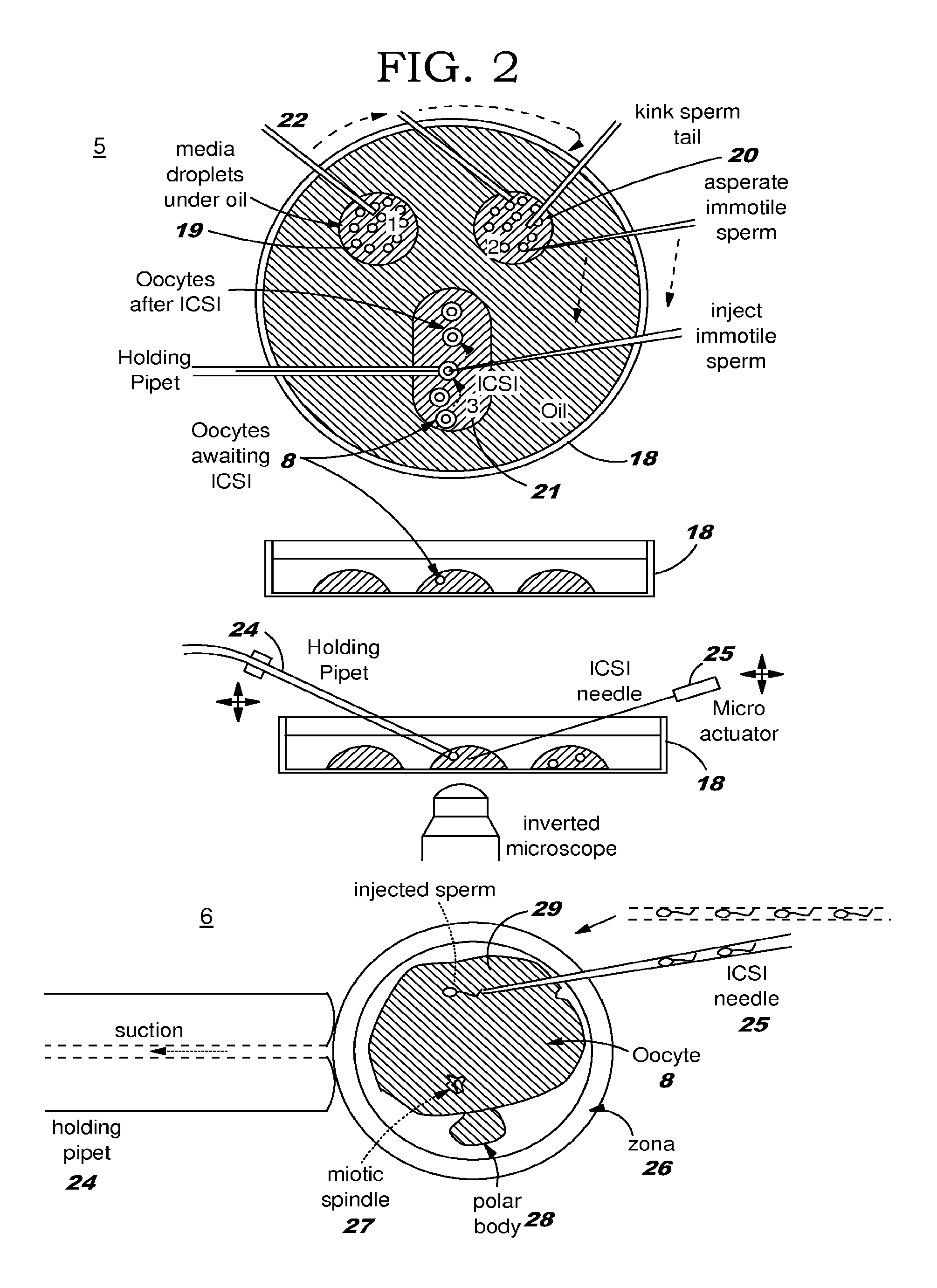 Microfluidic Embryo and Gamete Culture Systems