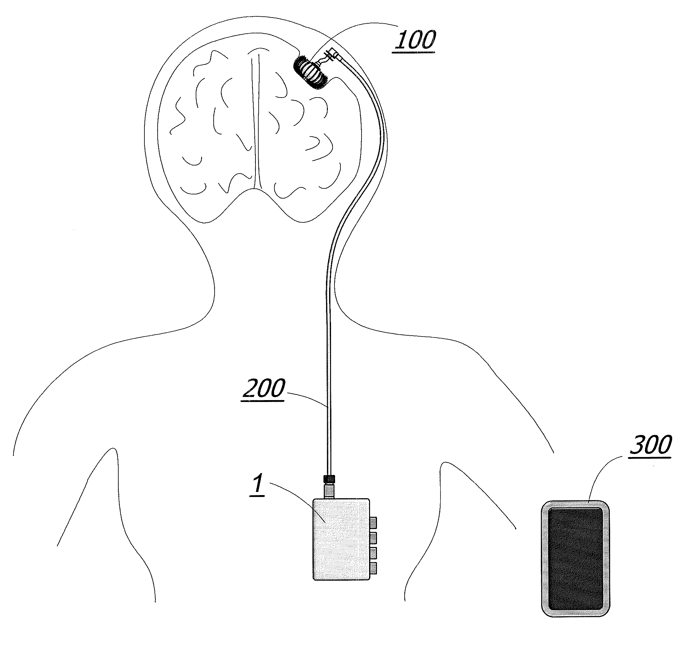 Magnetic Breather Pump and a Method for Treating a Brain Tumor Using the Same