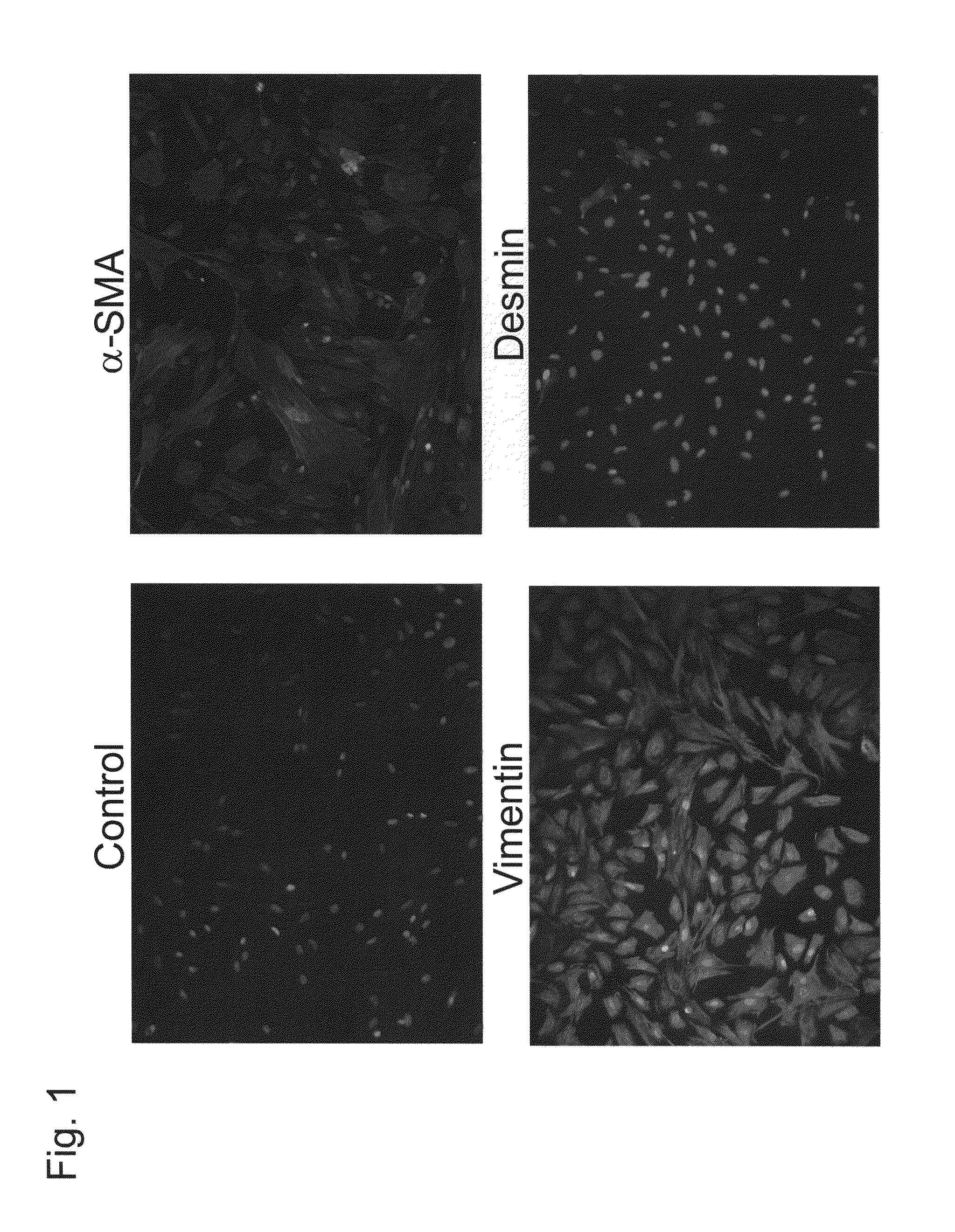 Targeting agent for cancer cell or cancer-associated fibroblast