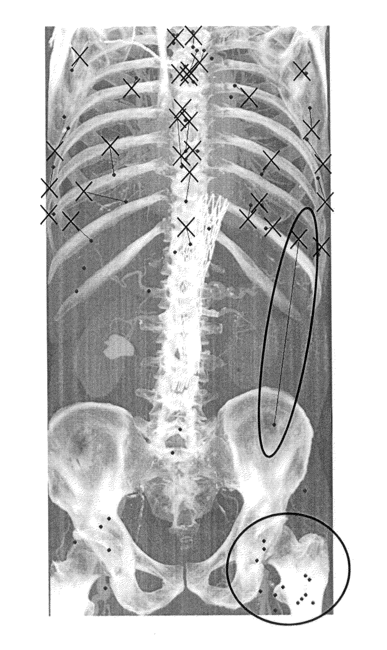 Positioning anatomical landmarks in volume data sets