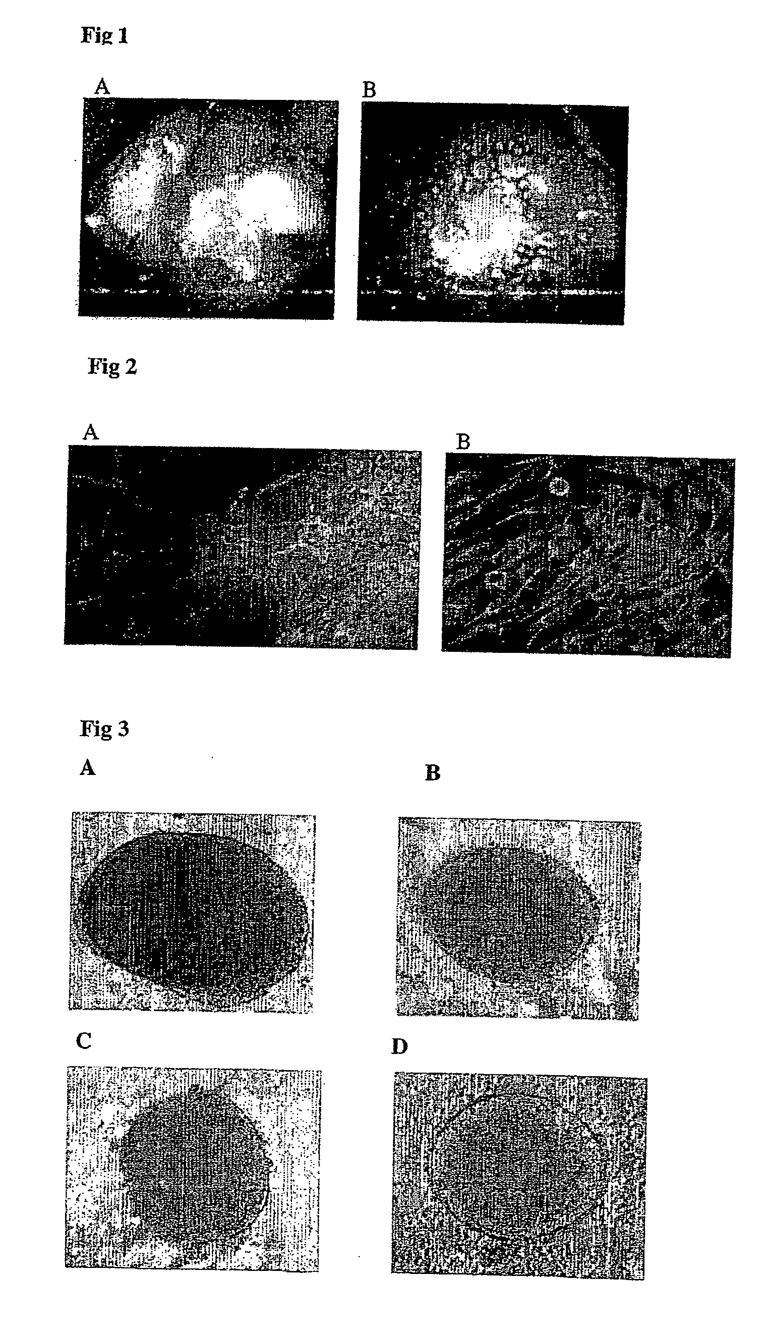 Generation of neural stem cells from undifferentiated human embryonic stem cells