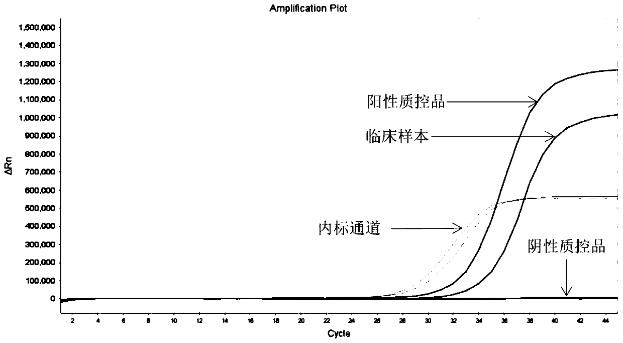 Kit for detecting KRAS gene mutation