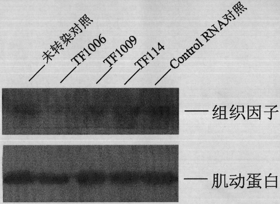 Oligonucleotide for inhibiting blood-mediated inflammatory reaction in pancreatic islet transplantation