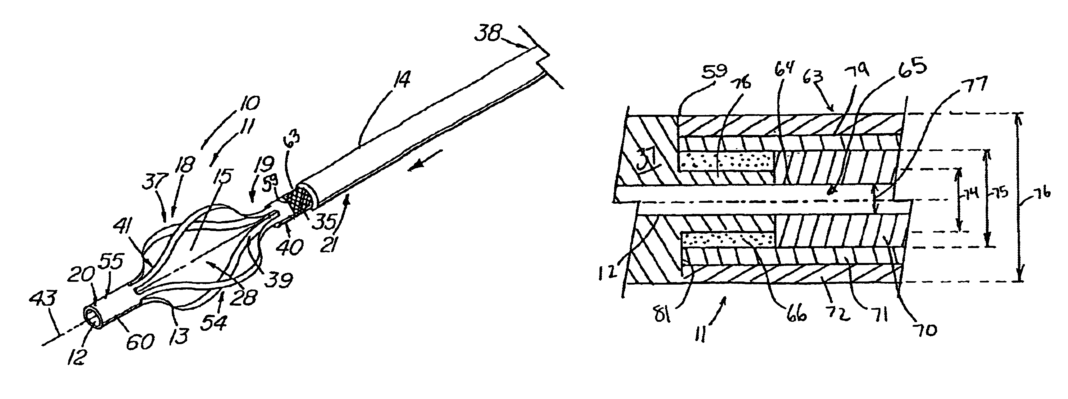 Minimally-invasive medical retrieval device