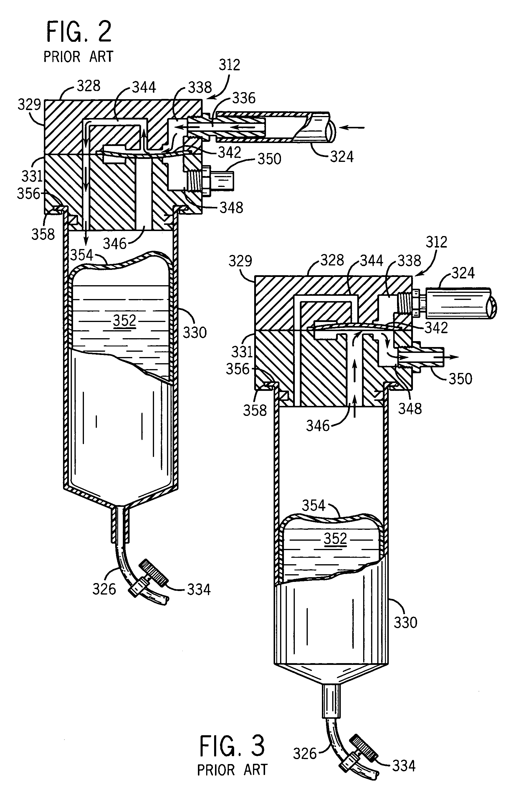 Dental handpiece fluid supply technology