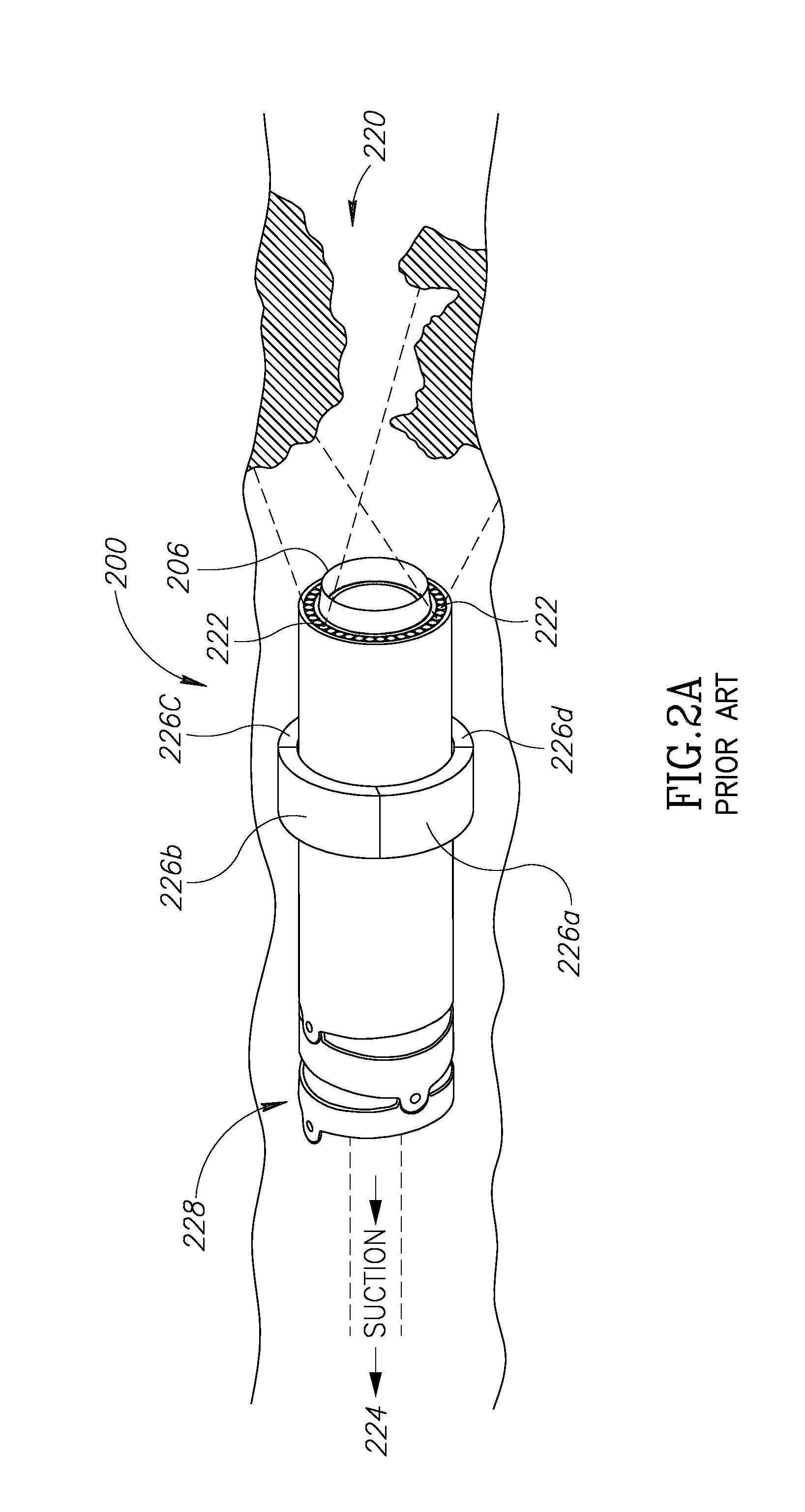 Hybrid catheter apparatus and methods