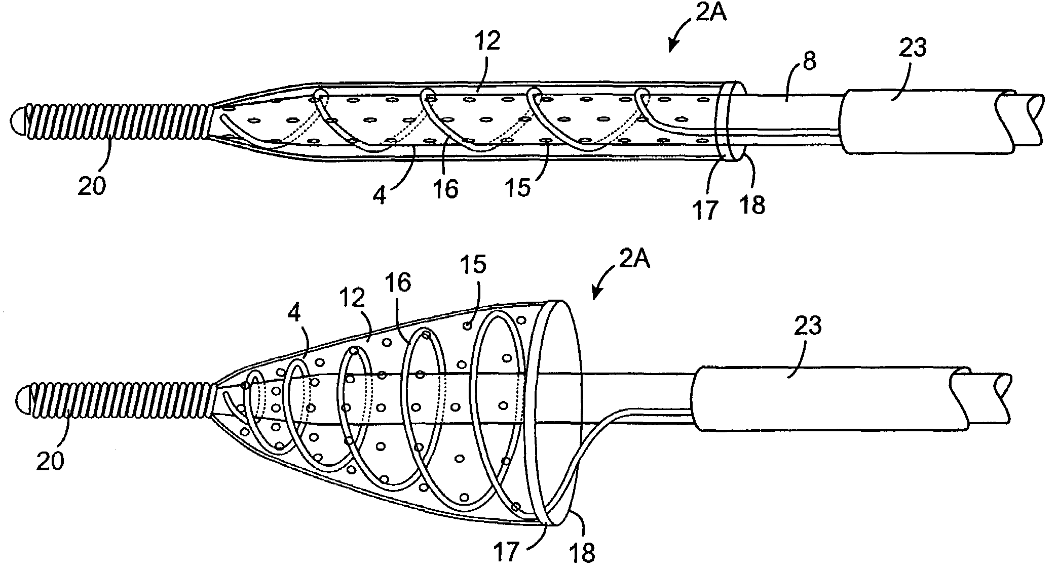 Methods and devices for filtering fluid flow through a body structure