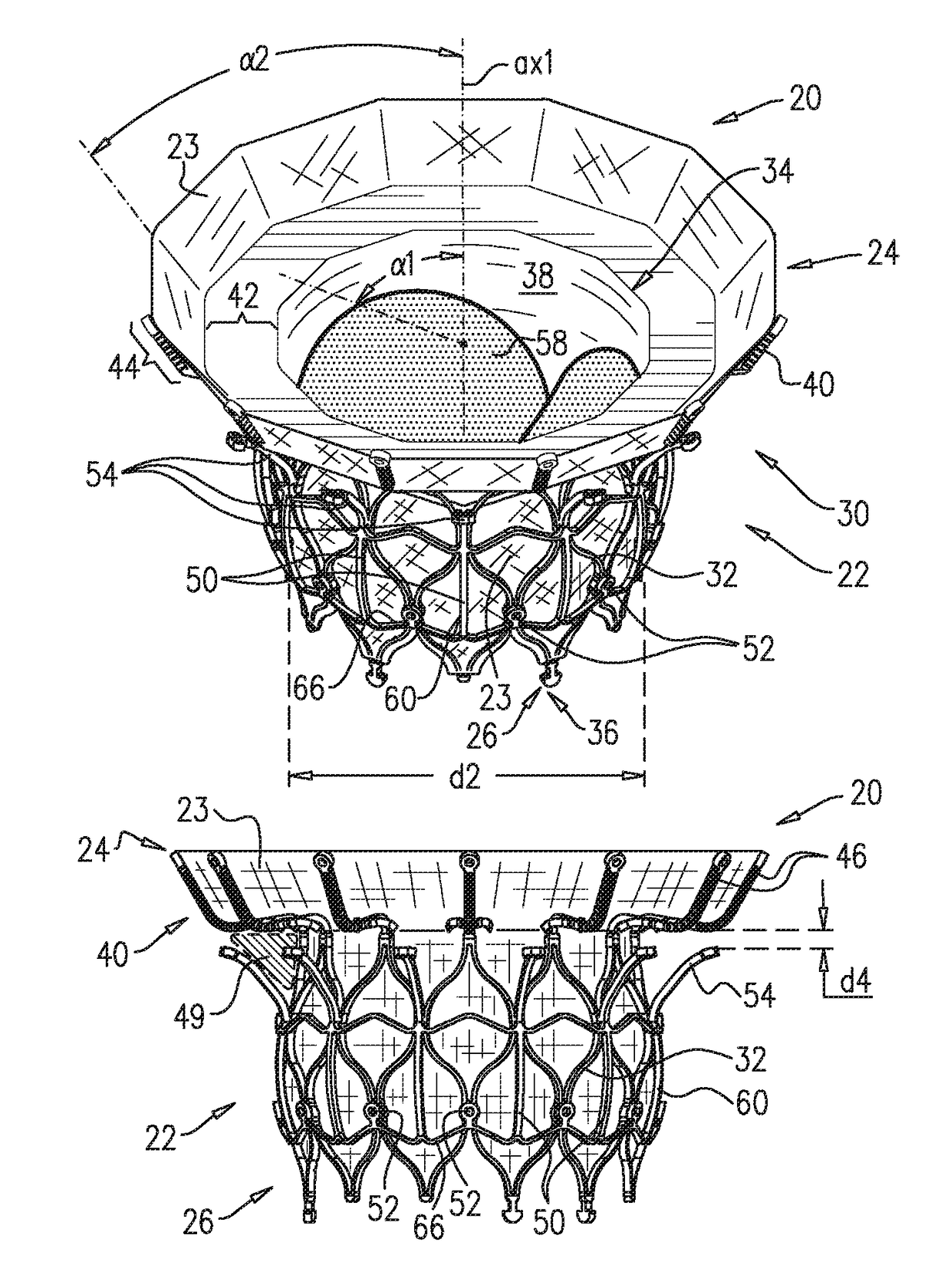 Prosthetic valve with axially-sliding frames