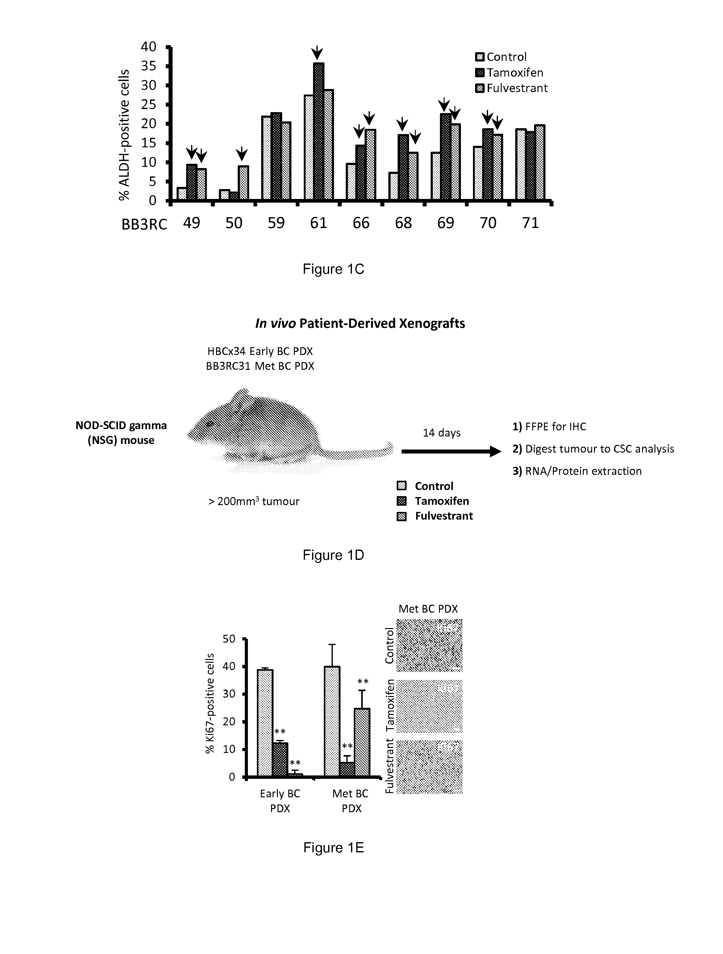 Breast Cancer Biomarker