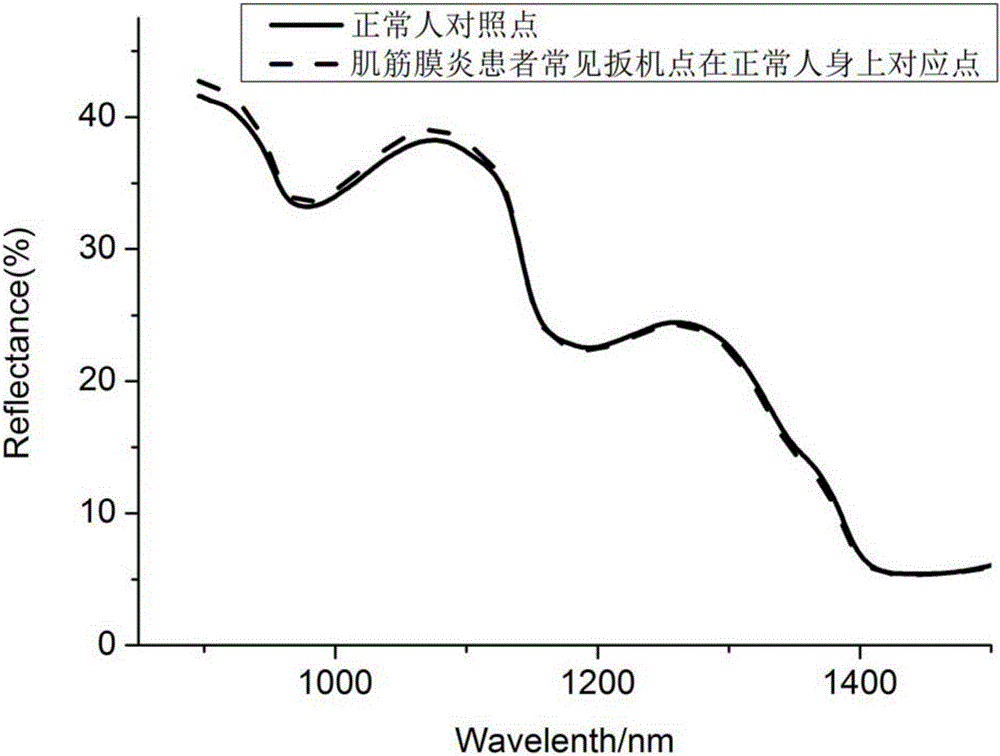 Optical instrument for automatically searching myofascitis trigger point